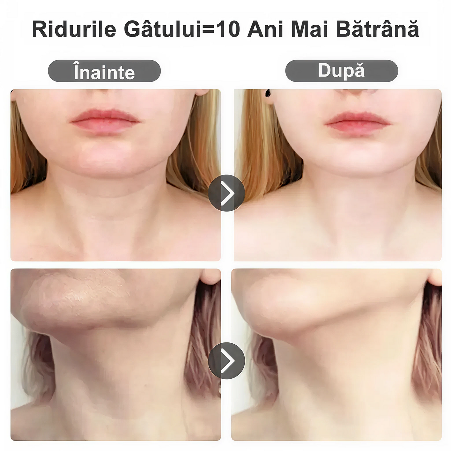 Dispozitiv Profesional de Lifting Facial si Gat – Masaj Reducere Riduri & Barbie Dubla, Remodelare Faciala